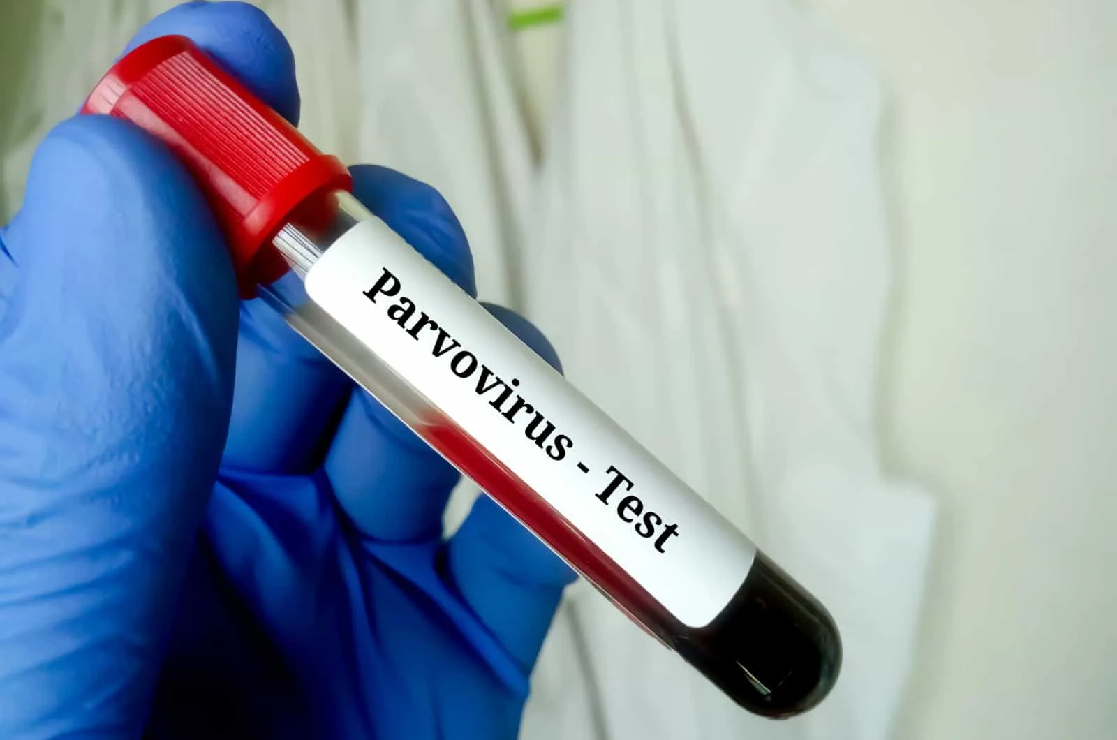 Blood sample for Parvovirus test