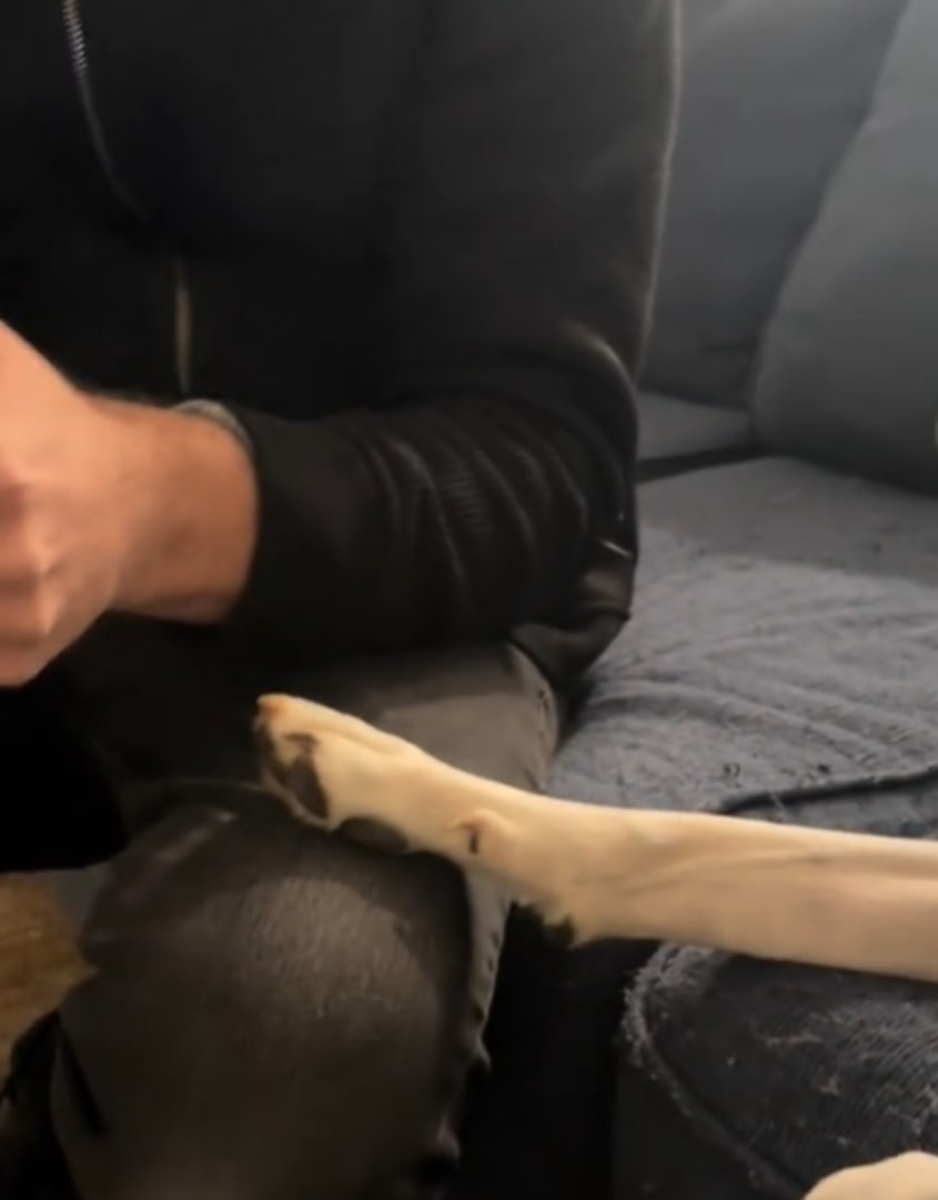 dogs leg on owner